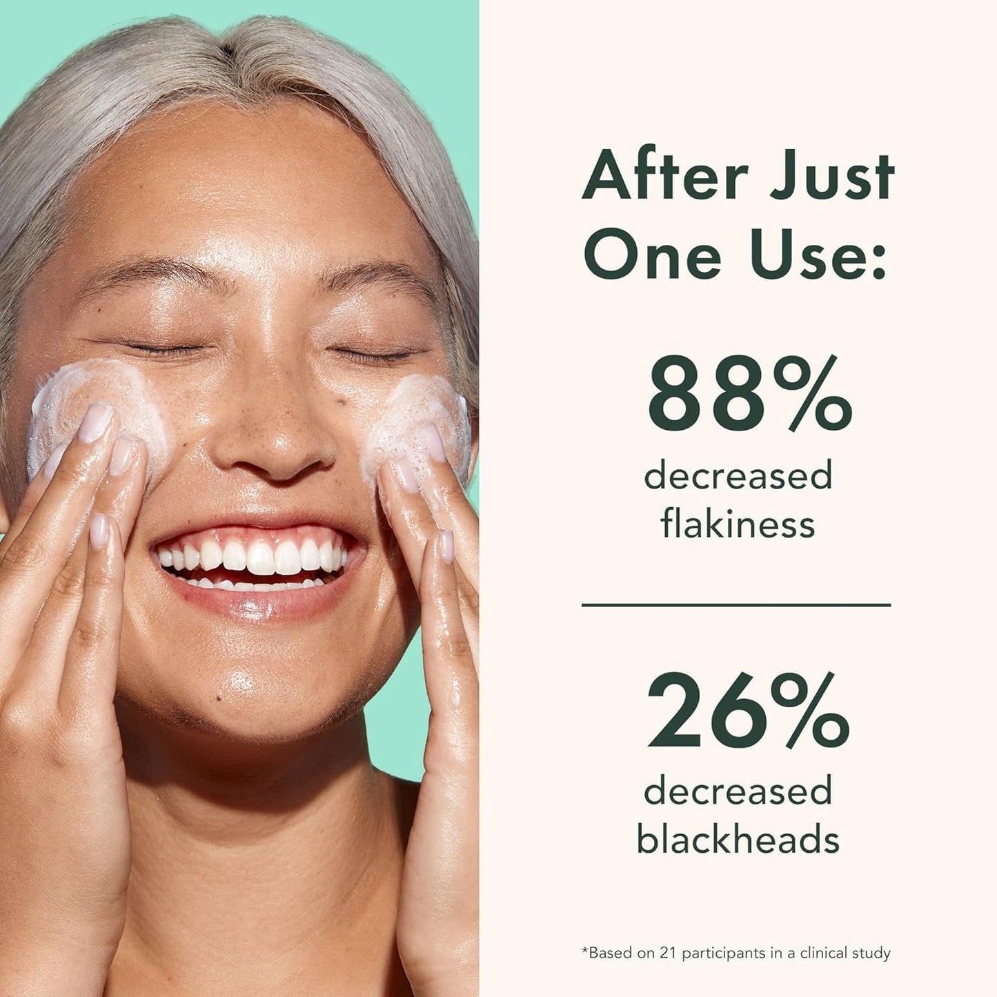 Rael Beauty Miracle Clear Face Exfoliating Cleanser With Succinic , Salicylic And Wintergreen Extract, 150 ml / 5 fl. oz
