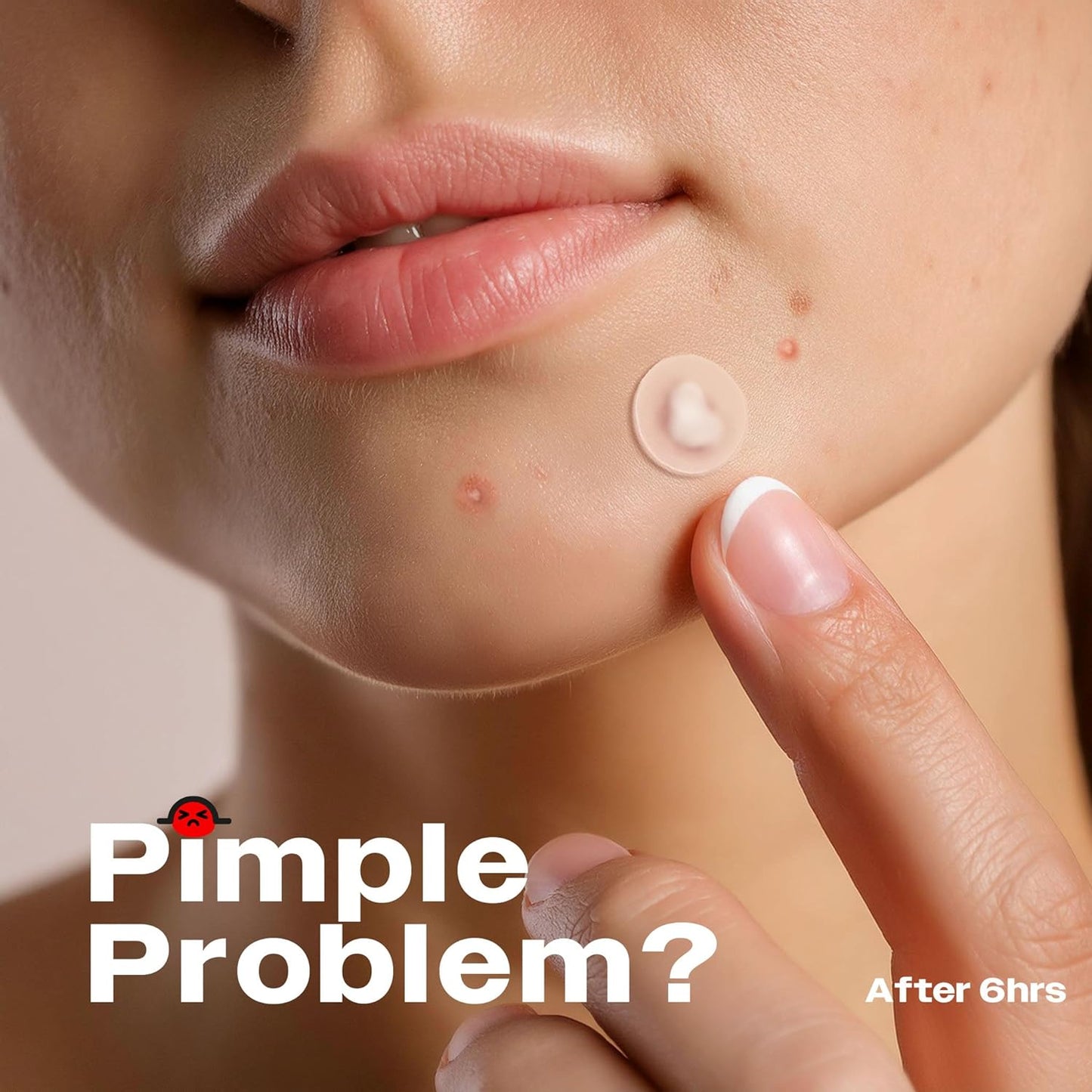 Avarelle Zitout Original Pimple Patches 40 Patches PACKAGING MAY VARY