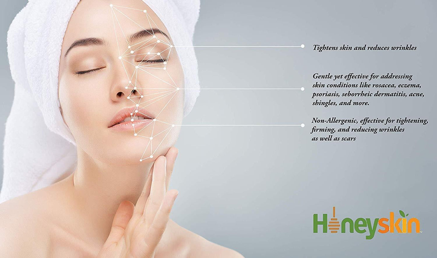 HoneySkin Face and Body Cream Moisturizer - Nourishing Aloe Vera - Manuka Honey for Rosacea Eczema Psoriasis Rashes Itchiness Redness - Natural Organic Cracked Skin Relief - Anti Aging - Anti Wrinkle (4 oz)
