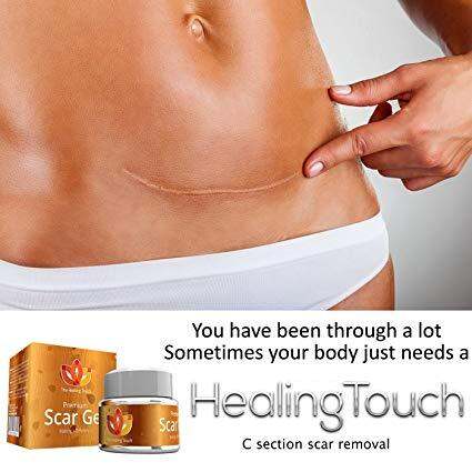 The Healing Touch Premium Scar Gel