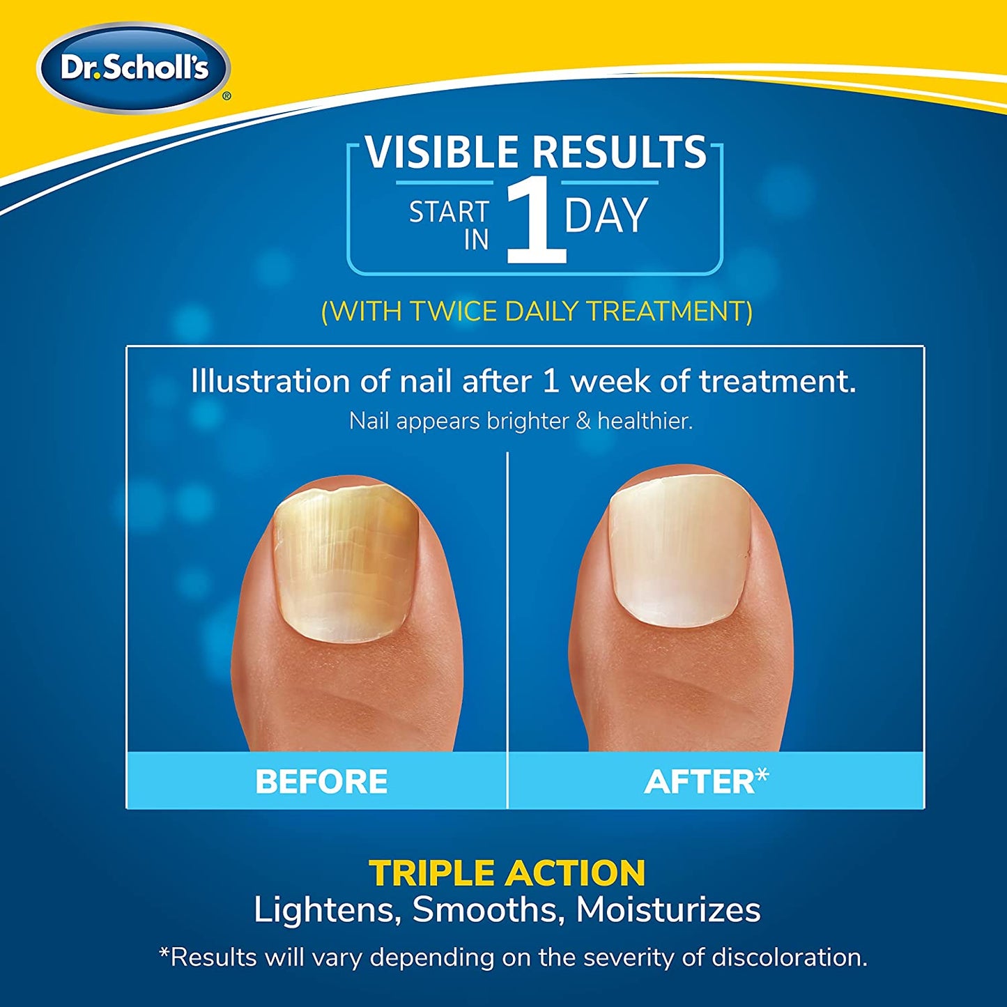 Dr. Scholl's Fungal Nail Revitalizer Light-Activated Therapy LED Light-Activated Therapy - 10ml