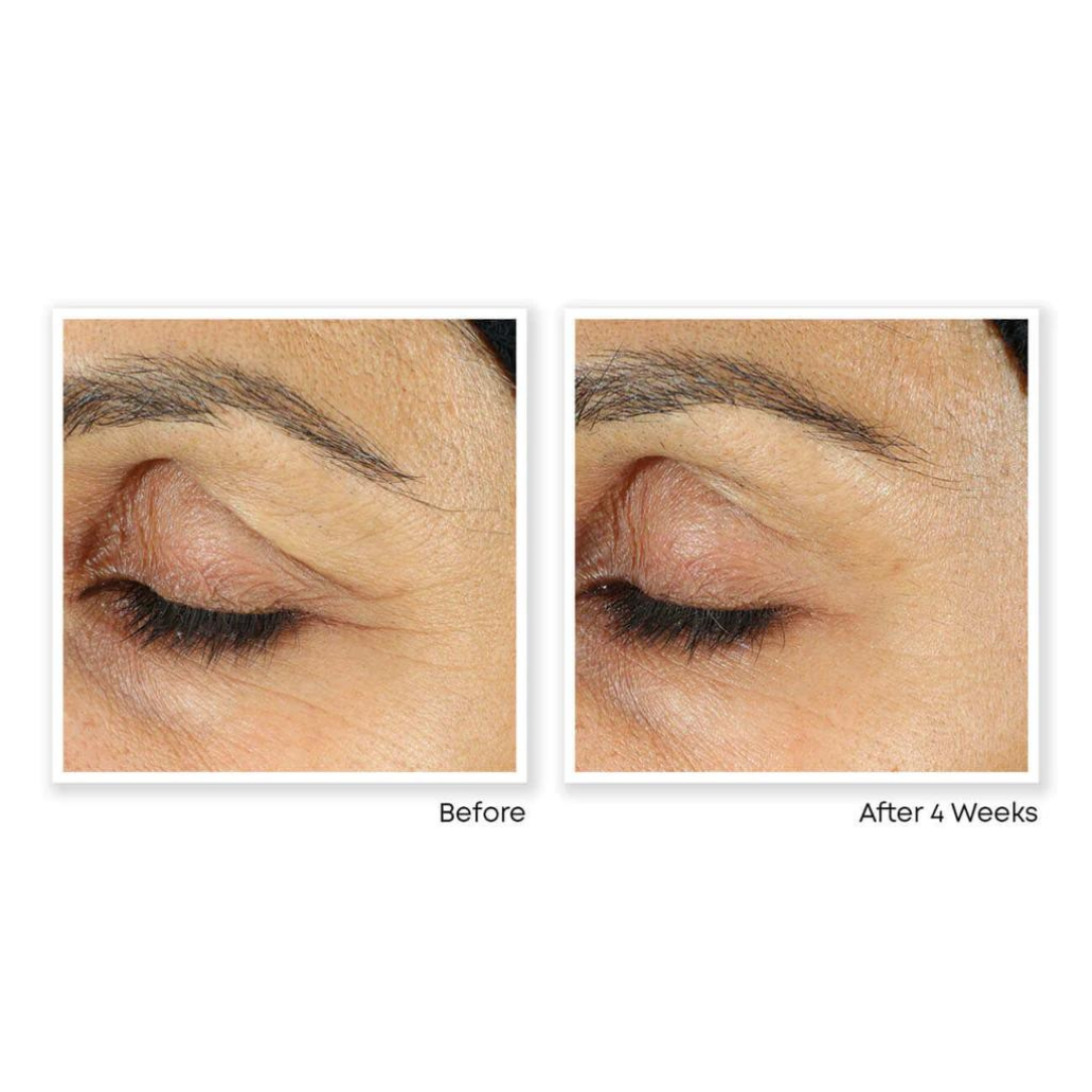 RoC Multi Correxion Even Tone + Lift Eye Cream Anti - Aging Treatment Cream 0.5 Fl Oz / 15ml