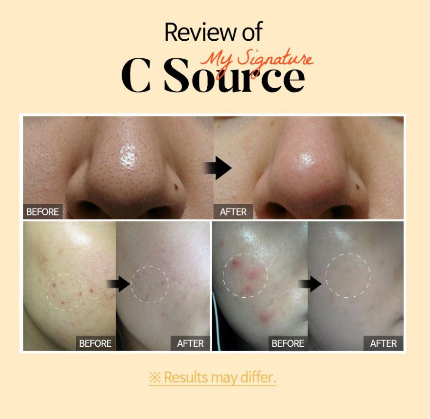 TIAM My Signature C Source Vitamin C Serum 30 ml