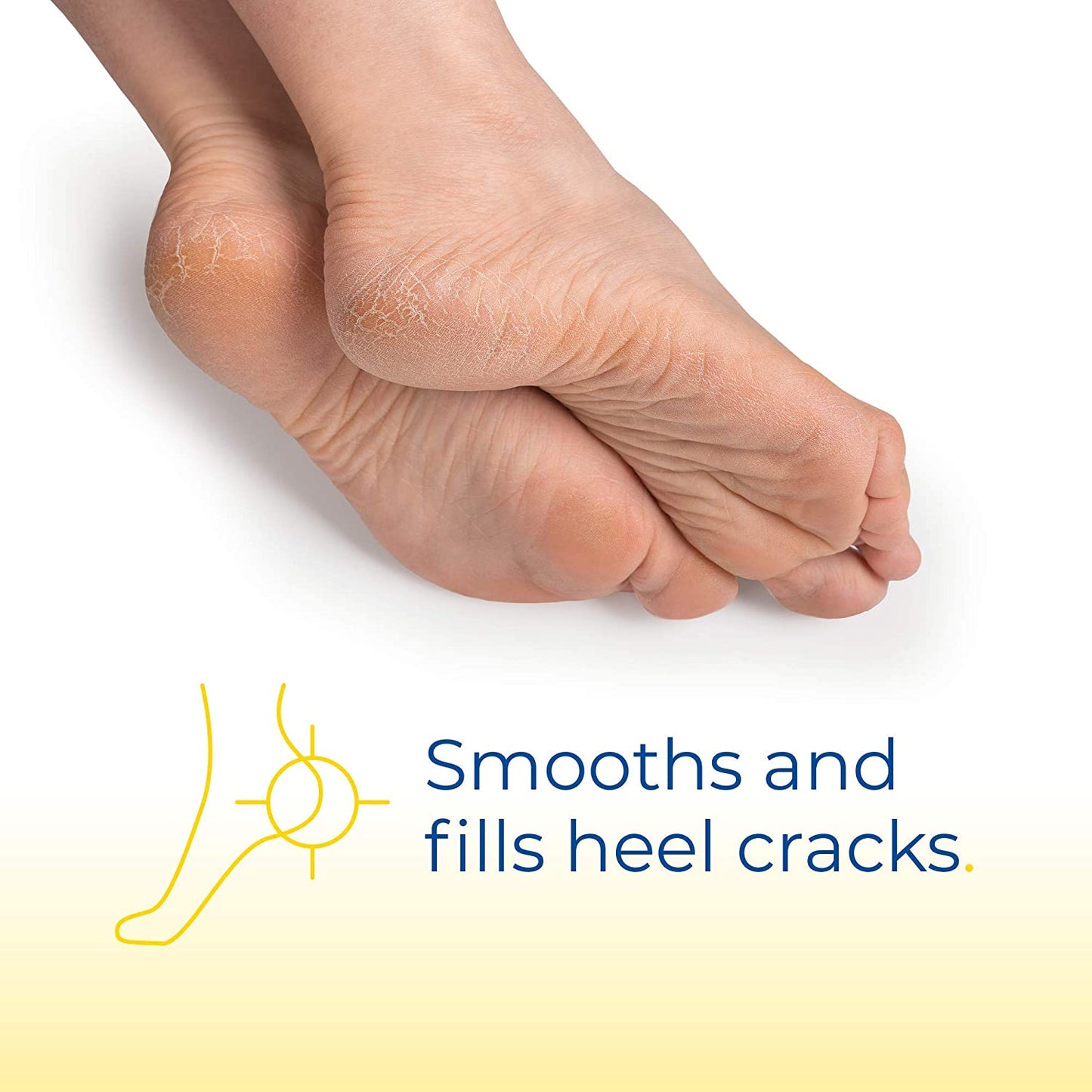 Dr. Scholl's Severe Cracked Heel Balm Softens & Hydrates Cracked Heels - 2.5OZ 70g