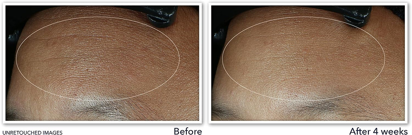RoC Retinol Correxion Line Smoothing Max Hydration Cream, 1.7 oz / 48 g (PACKAGING MAY VARY) NO BOX