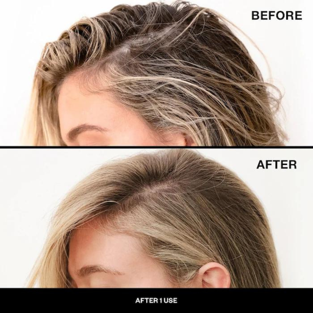 IGK First Class Charcoal Detox Dry Shampoo - 288ml / 6.3oz