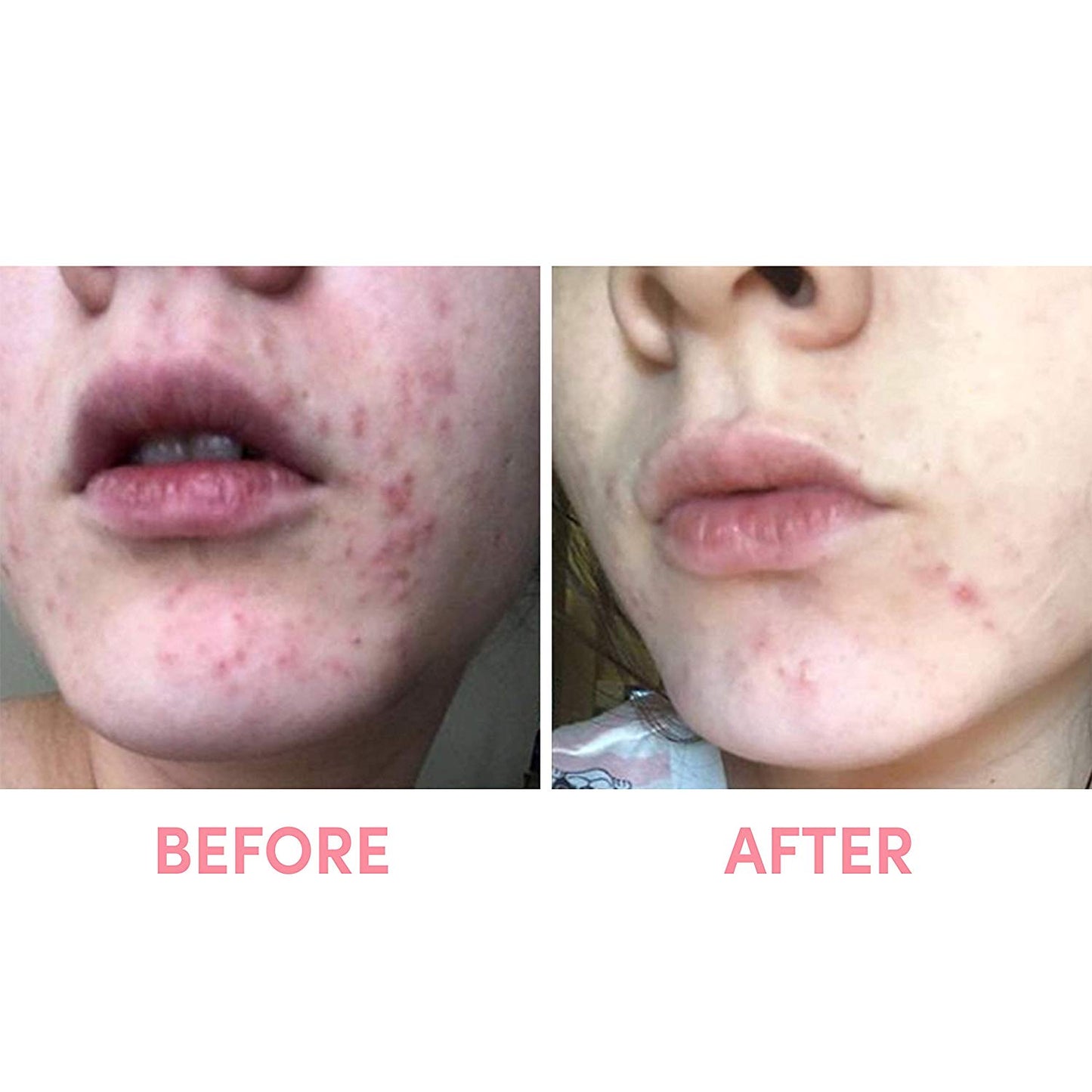 Sand & Sky Australian Pink Clay Porefining Face Mask (60 g) Detoxify + Brighten