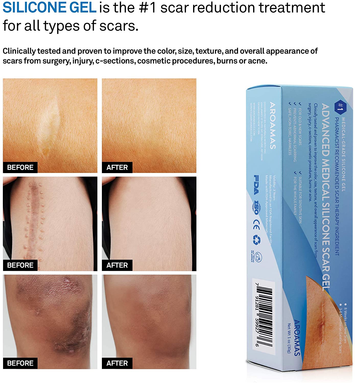 Aroamas Silicone Scar Gel, 30 g for for Surgical Scars, Face, Keloids, C-Section, Cosmetic Procedures, Burns, Injuries