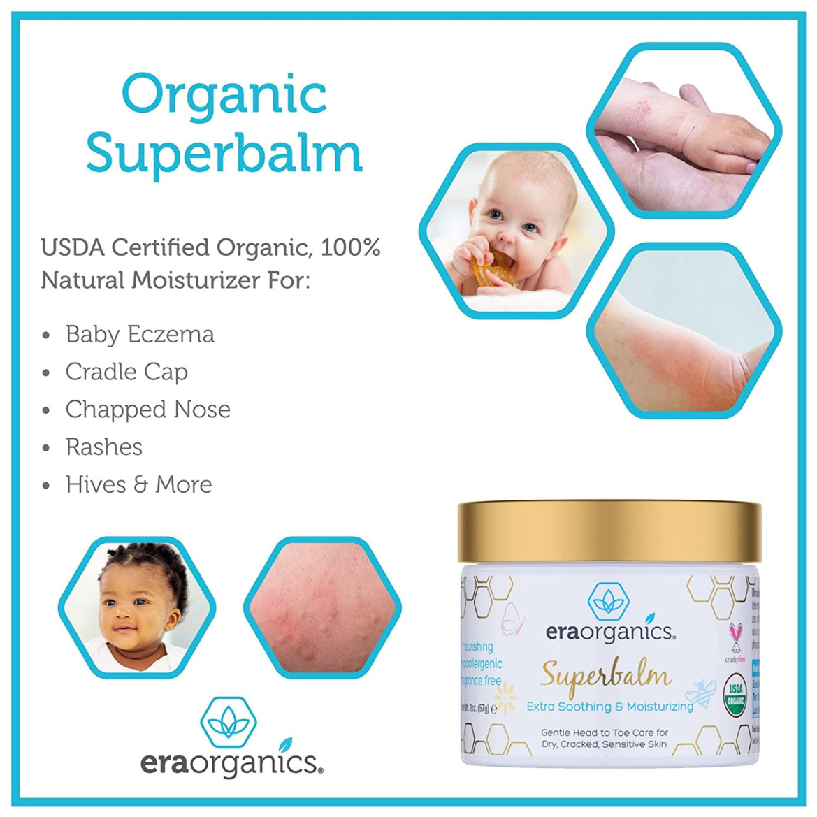 Era Organics Superbalm Extra Soothing & Moisturizing For Dry Cracked Sensitive Skin 2 Oz (57g)