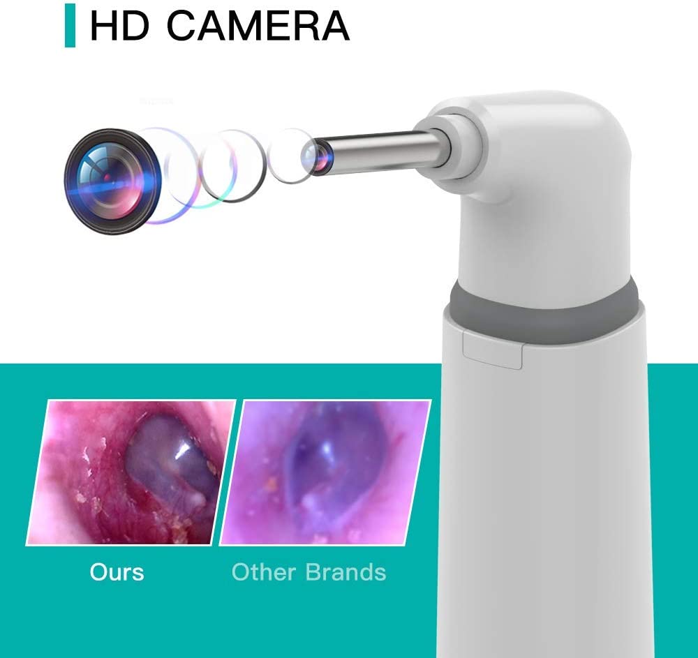 Any Kit Wireless Otoscope Ear Camera 720P HD With 6 LED Lights Compatible with Android and iPhone 1 Count