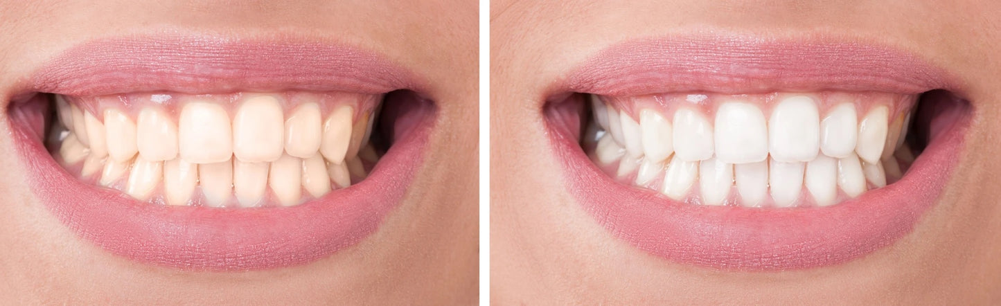 Smile Sciences RX Strength Teeth Whitening Pens, 2 Count