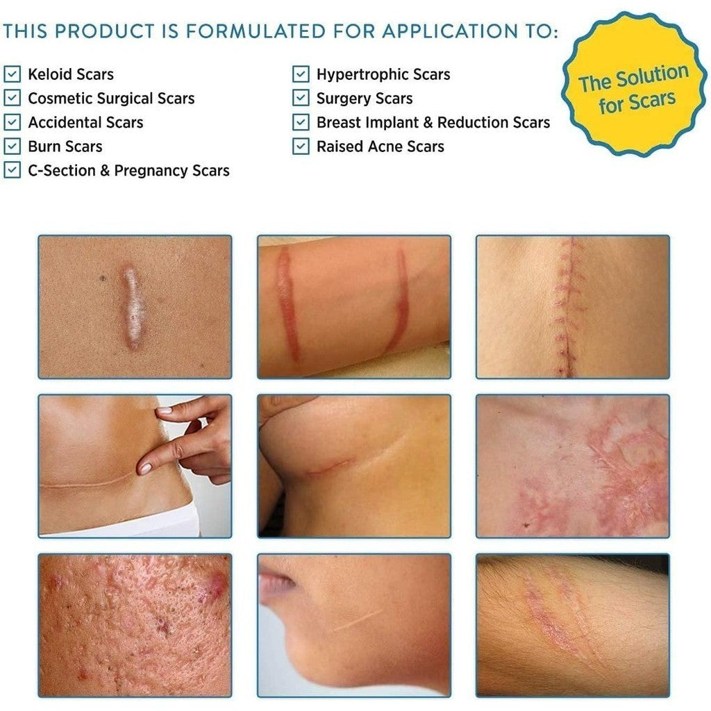 Aroamas Scar Advanced Silicone Scar Sheets (3 inch x 1.6 inch) 8 Reusable Sheets
