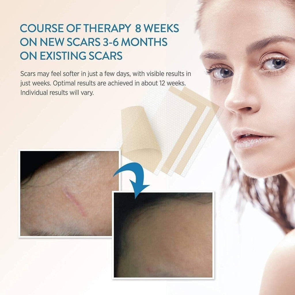 Aroamas Scar Advanced Silicone Scar Sheets (3 inch x 1.6 inch) 8 Reusable Sheets