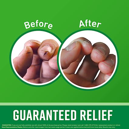 O'Keeffe's Working Hands Hand Cream for Extremely Dry Cracked Hands, 3.4 oz / 96 g