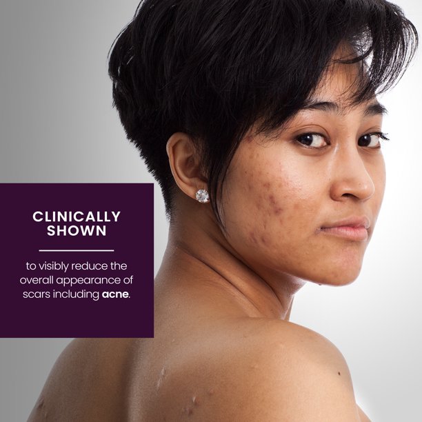 Mederma Advanced Scar Gel Treatment, 0.7 oz. / 20g