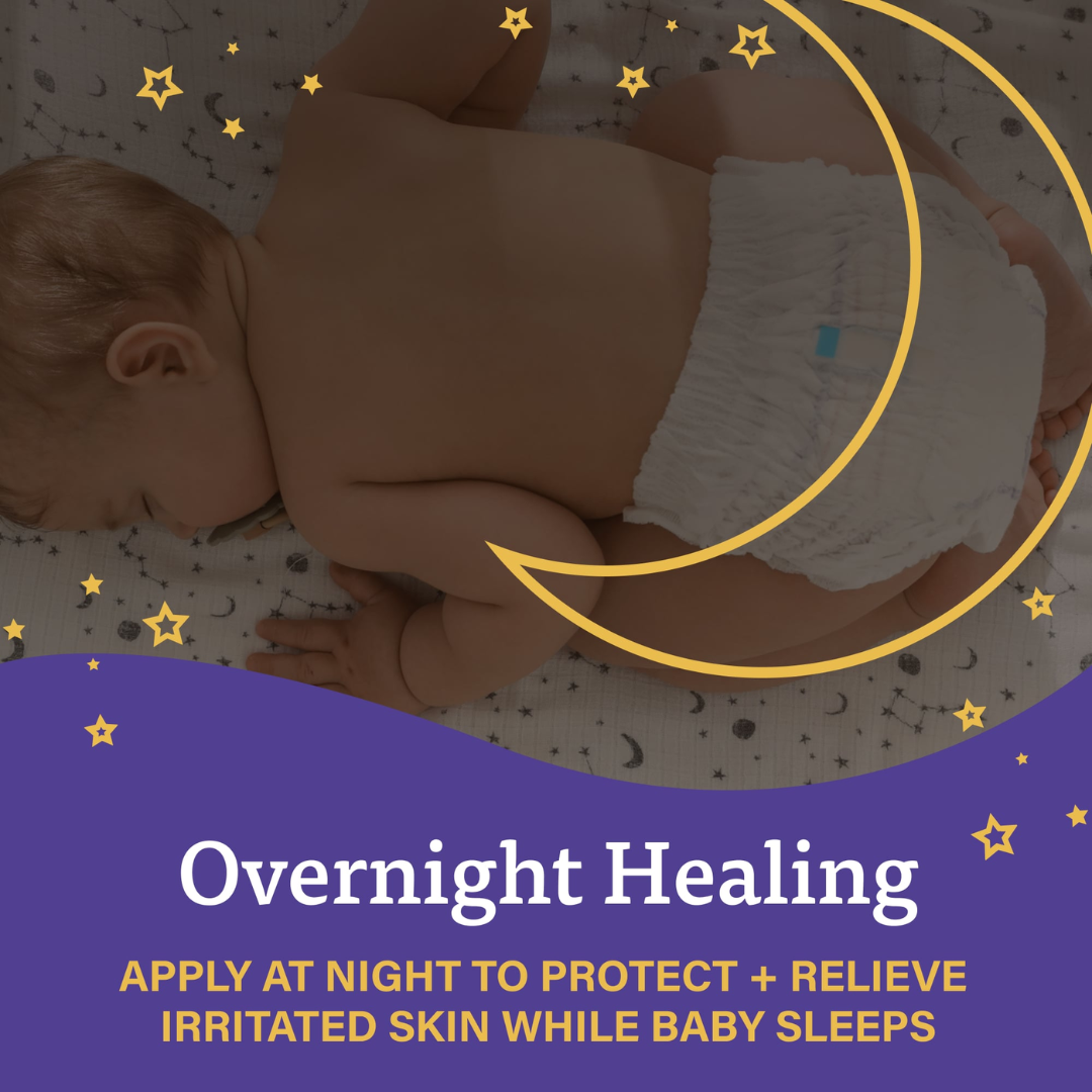 A+D Overnight Healing Rash Ointment, 3.6 oz / 102 g