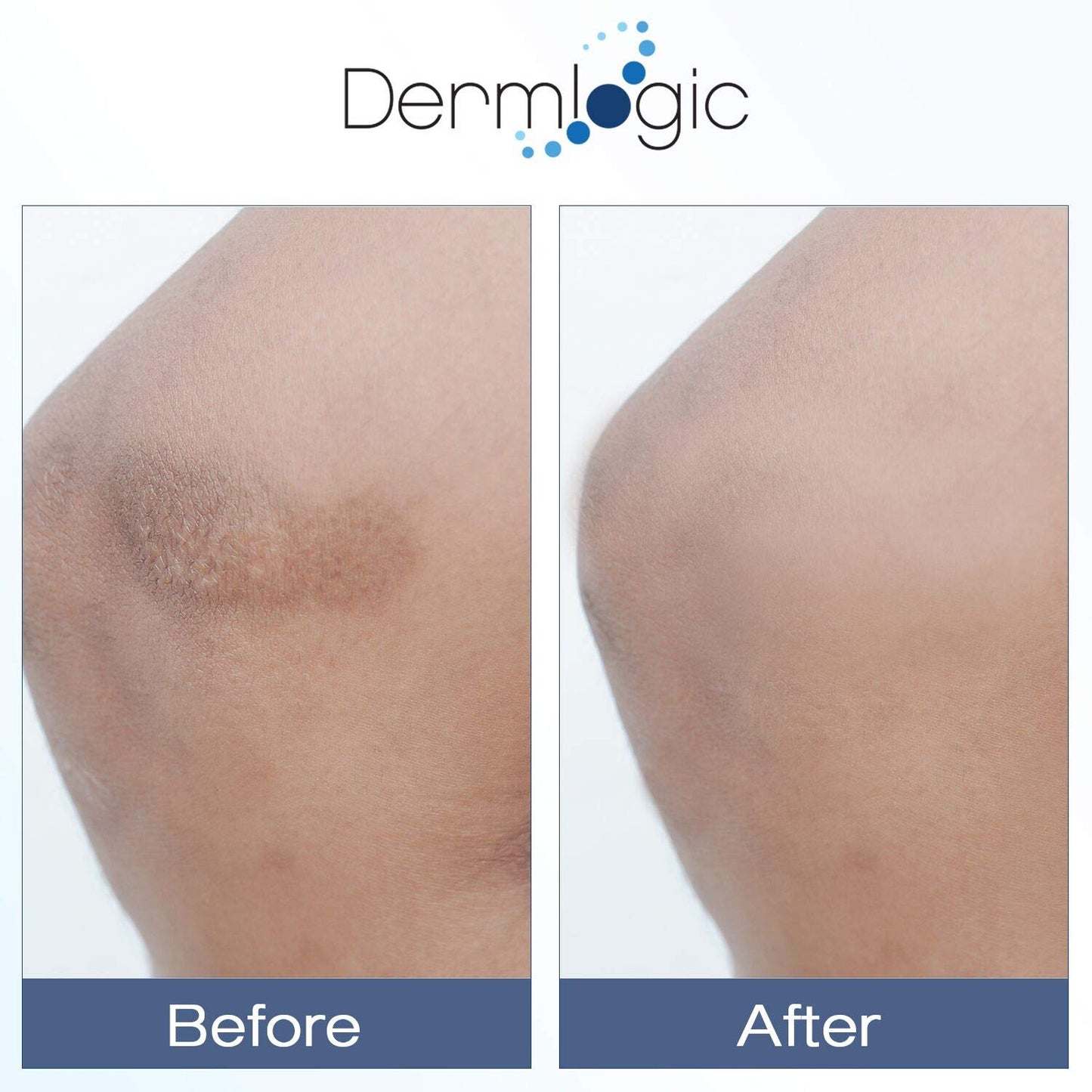 Dermlogic Advanced Vitamin K Cream with Arnica 60ml / 2 fl oz