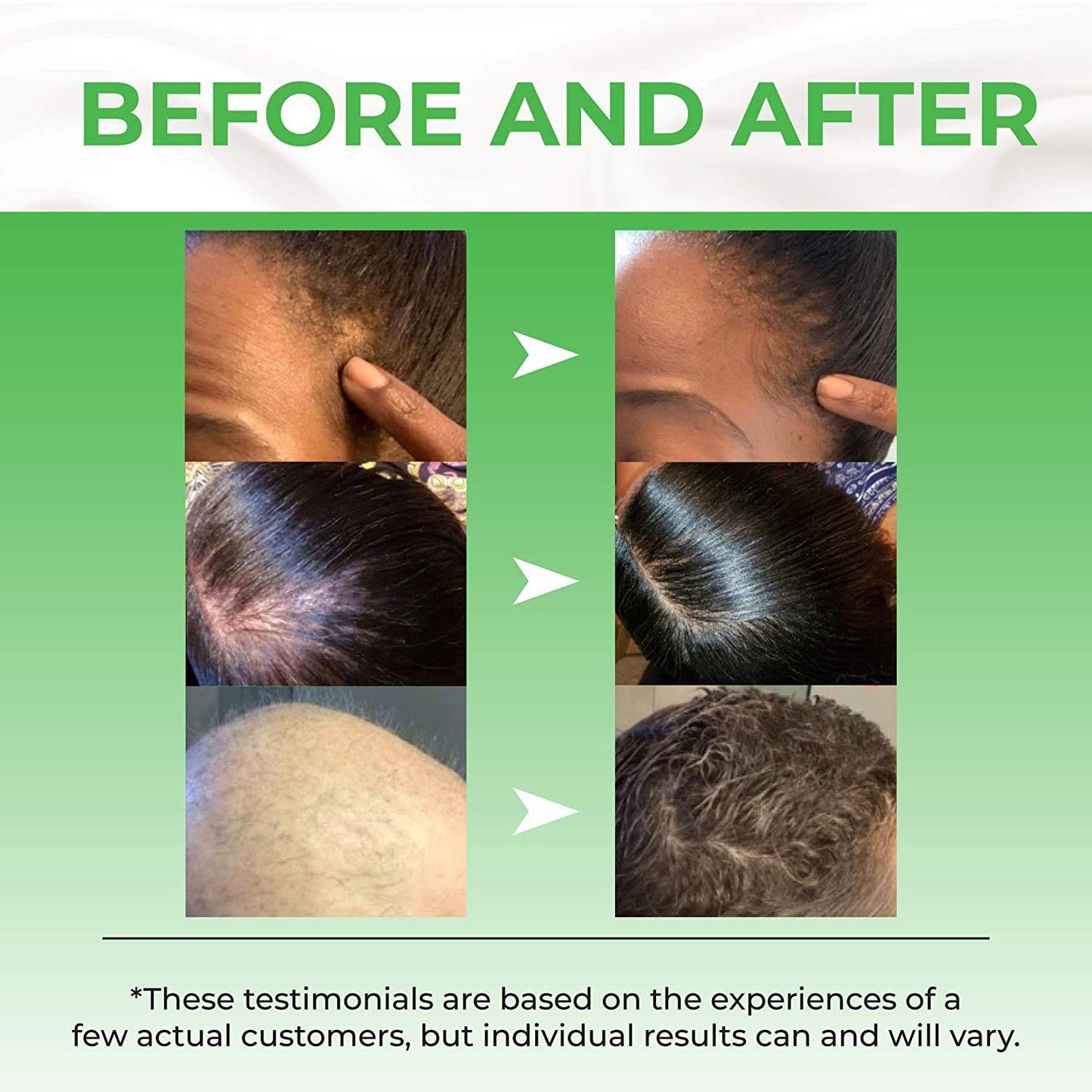 Pureauty Naturals Biotin Hair Serum Advanced Formula, 2 fl.oz / 60ml