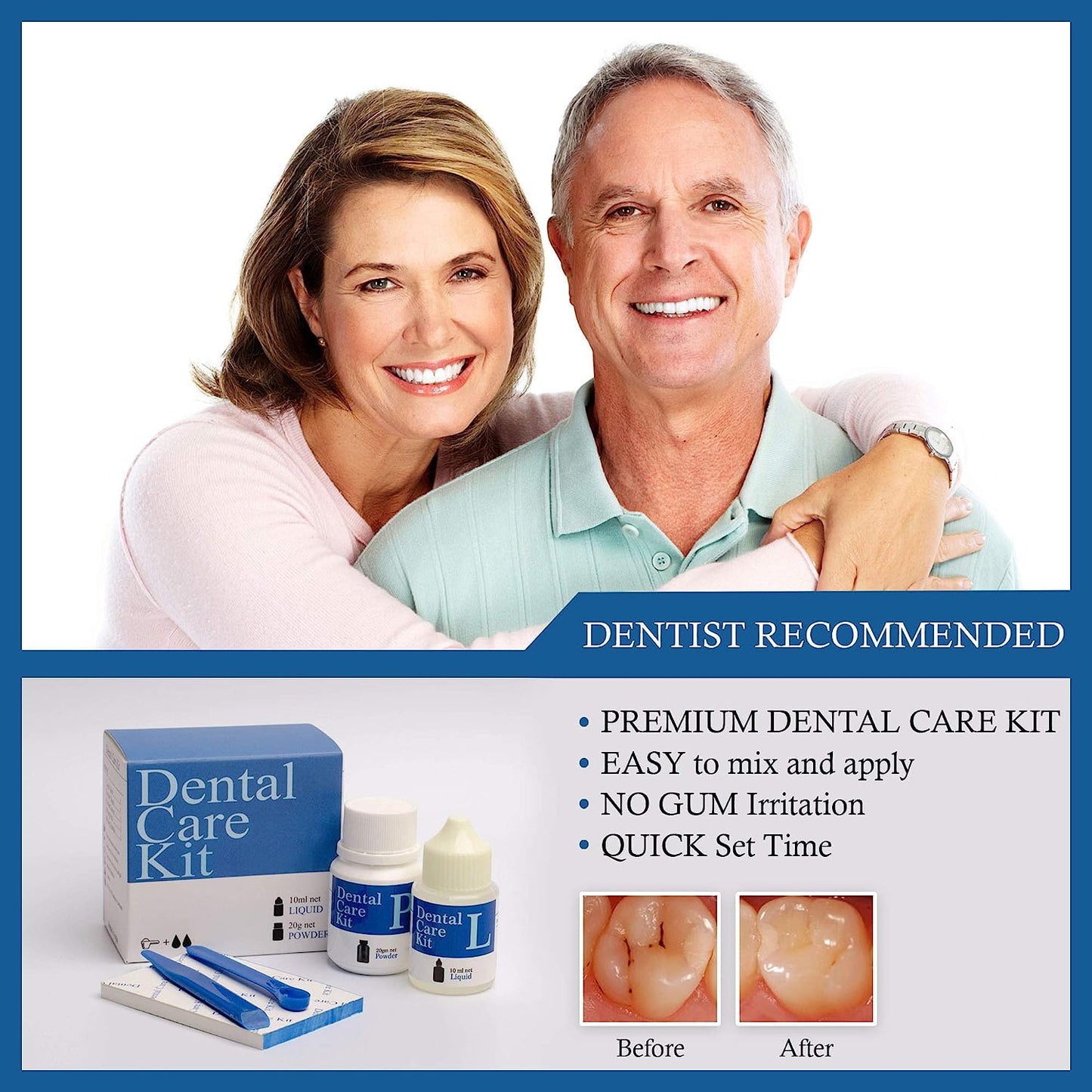 mastermedi Dental Care Kit Glue For Crown & Bridges Filing