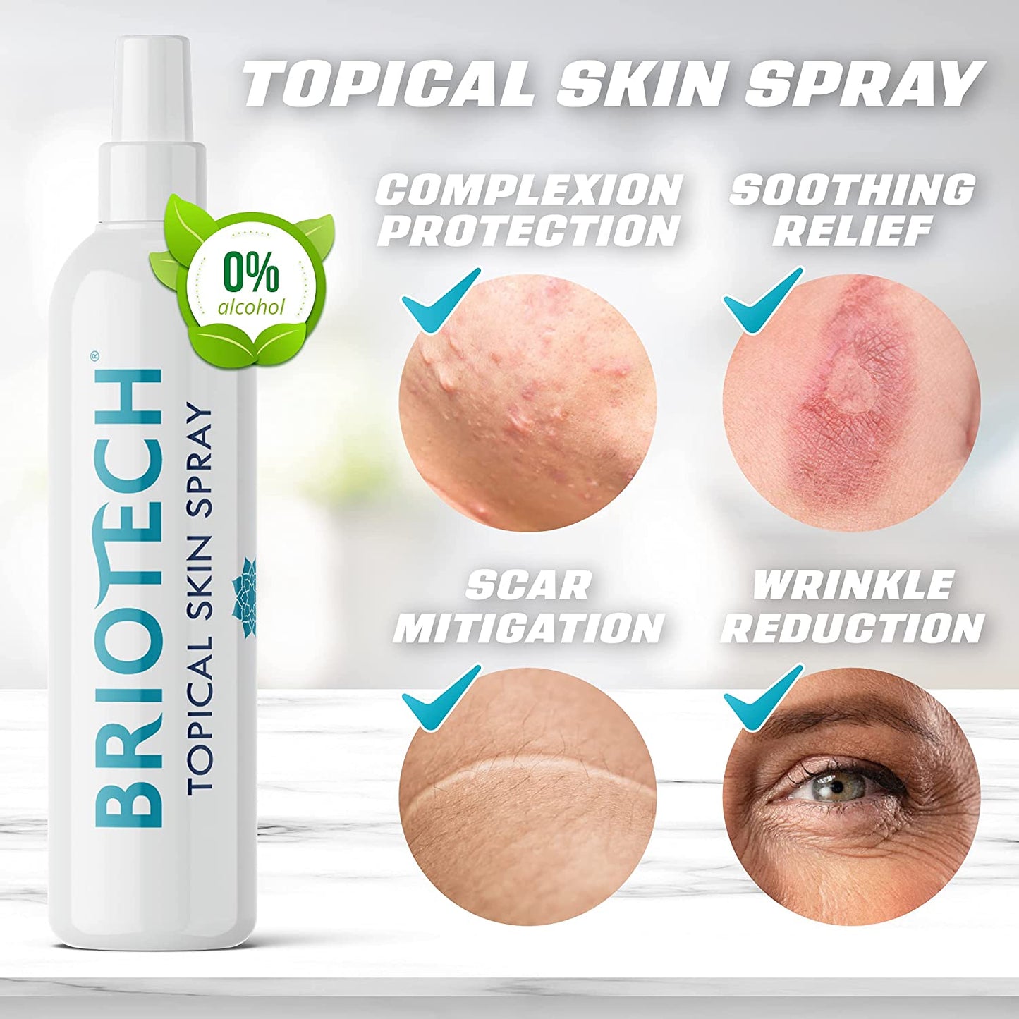 BRIOTECH Skin Relief Spray for Aftercare, Marks & Blemish Care Solution, 4 oz