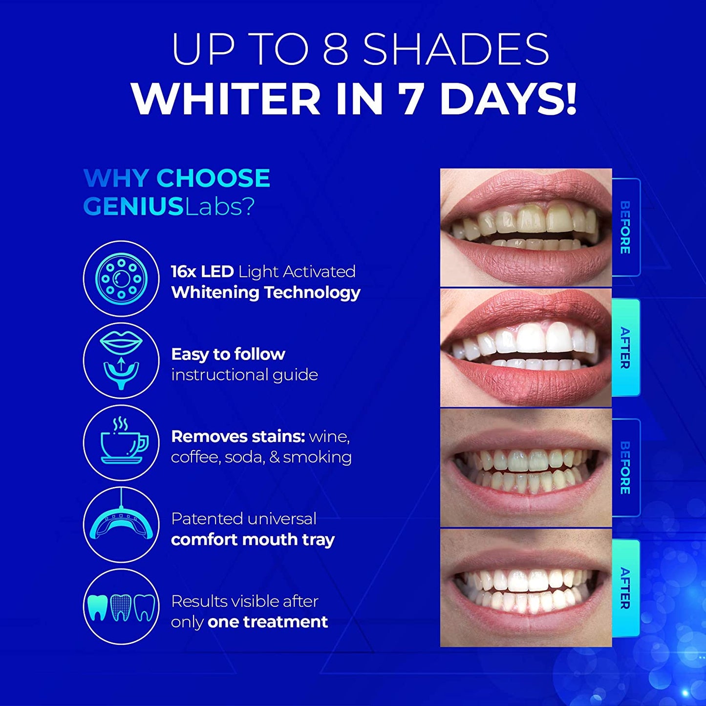 GENIUSLabs Teeth Whitening Kit, 16X LED Professional light for Whiter Teeth, 10 minute treatment