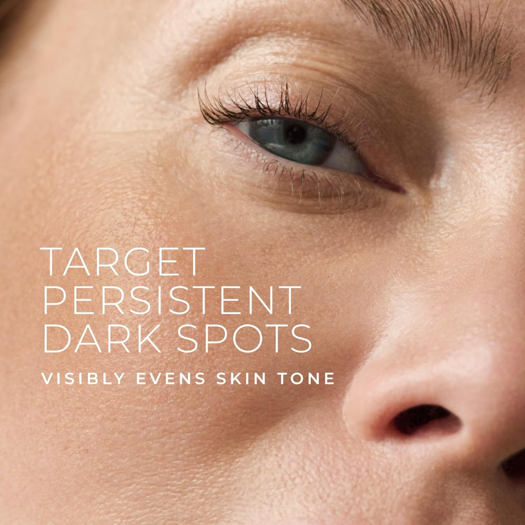 RoC Even Tone Dark Spot Moisturizer, 1.7 oz / 48 g