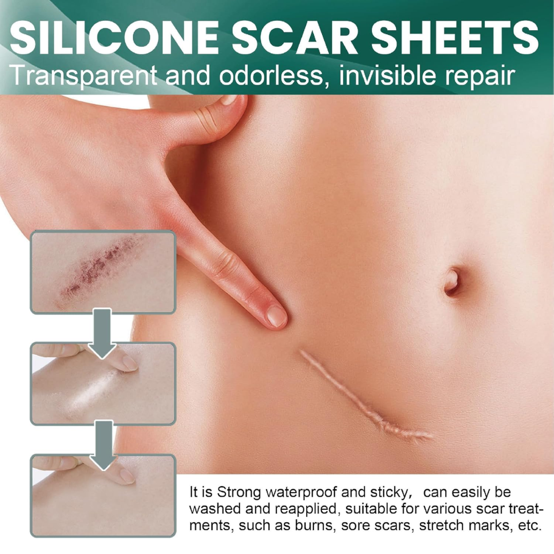 Budy Premium Silicone Scar Sheets 4 cm x 300 cm, 1 Roll