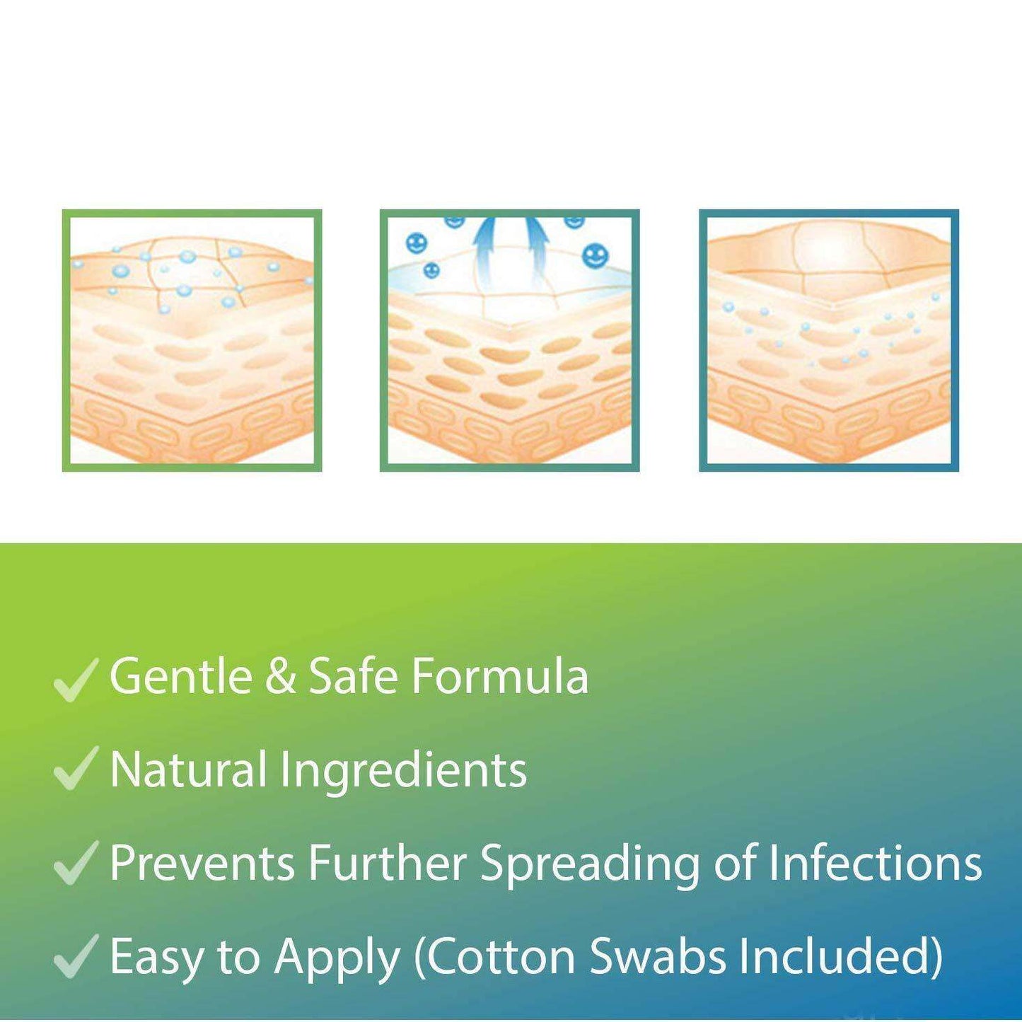 Evagloss Wart Remover Natural and Gentle Advanced Formula 10 mL NO BOX