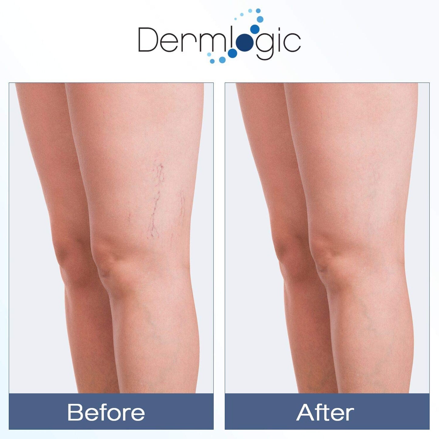 Dermlogic Advanced Vitamin K Cream with Arnica 60ml / 2 fl oz