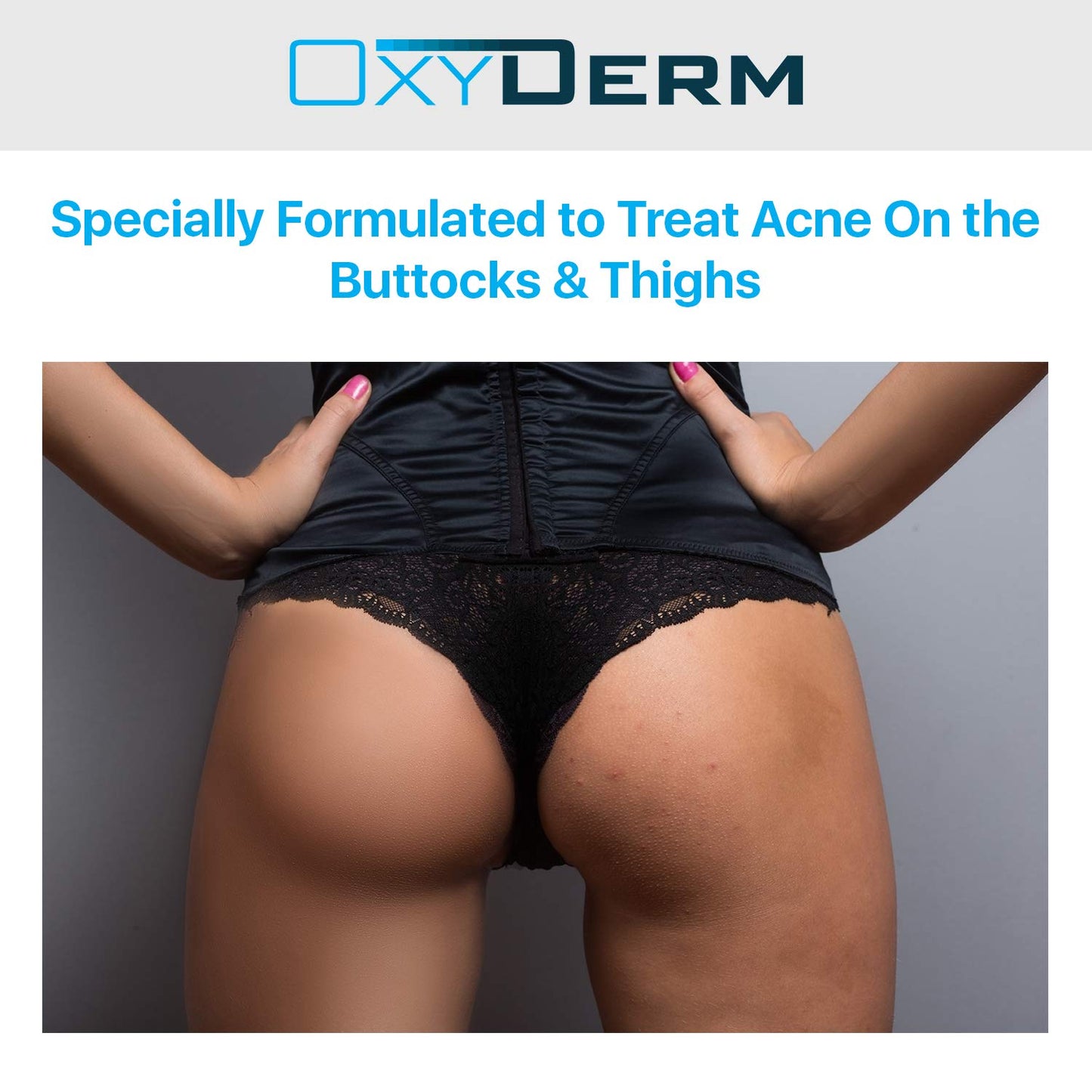 Oxyderm 3-In-1 Action Butt & Thigh Acne Treatment Peel Pads with Salicylic, Glycolic and Lactic Acid, 60 Medicated Pads