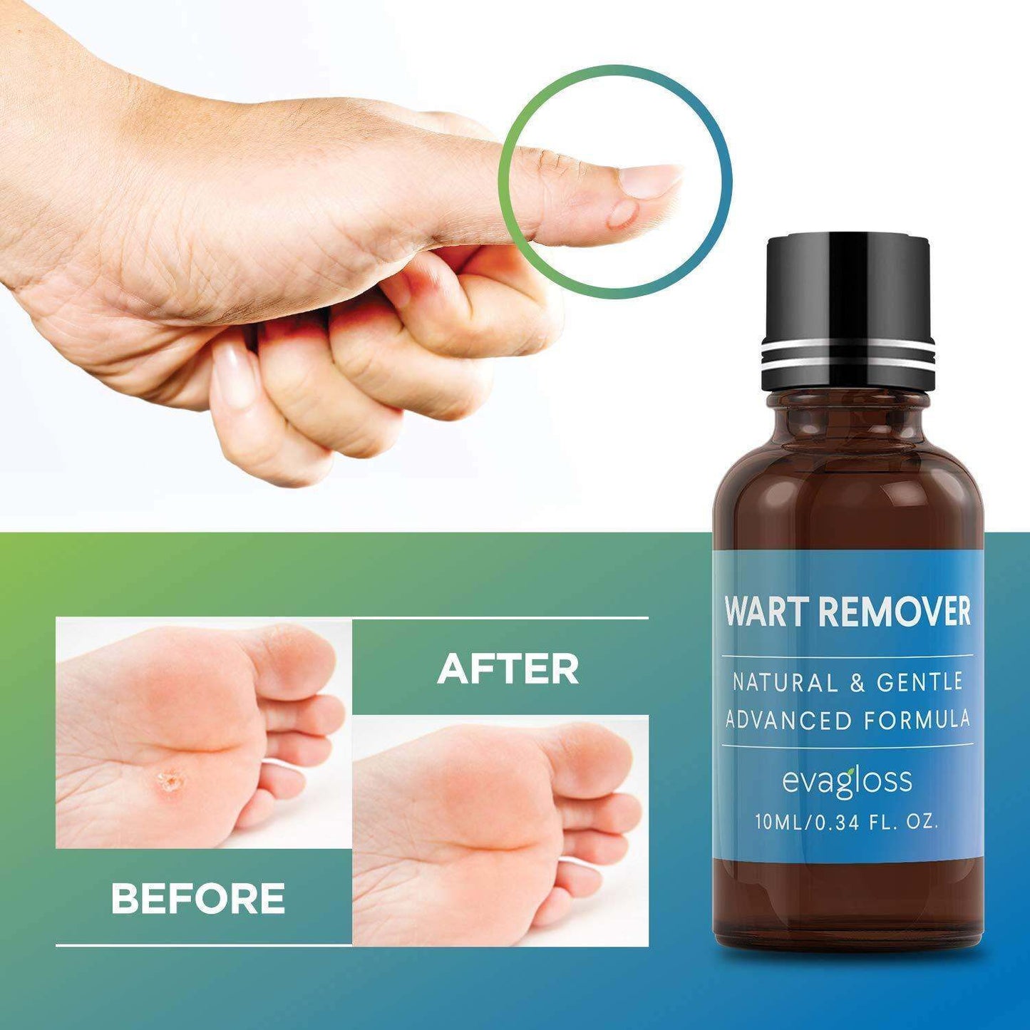 Evagloss Wart Remover Natural and Gentle Advanced Formula 10 mL NO BOX