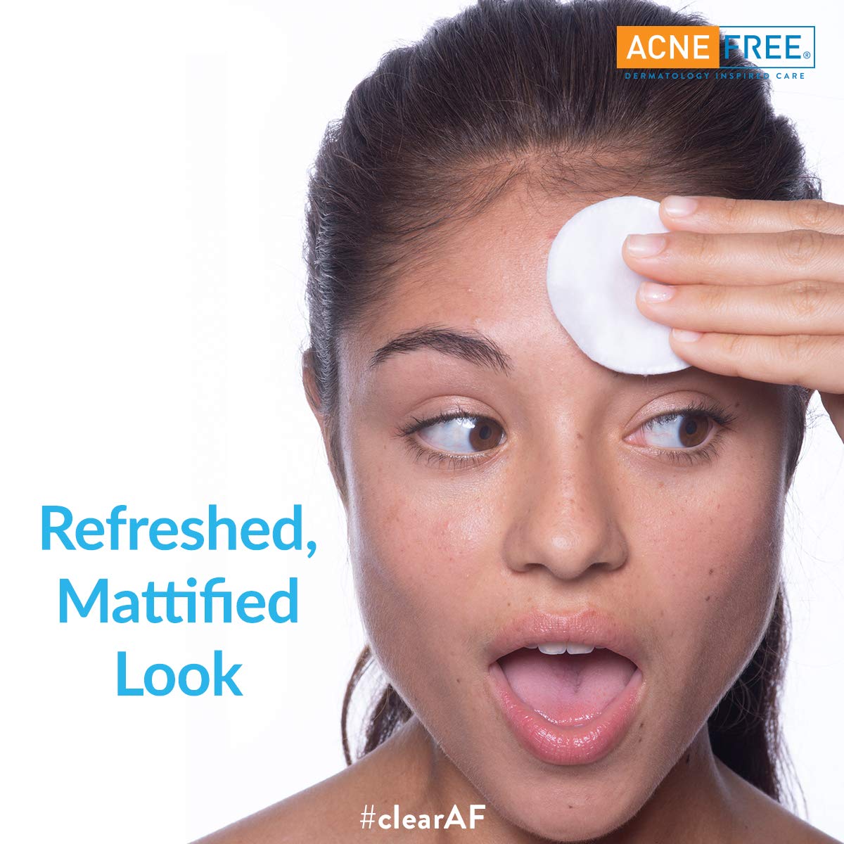 Witch Hazel Mattifying Toner with Glycolic Acid & Aloe Vera, 4 fl.oz