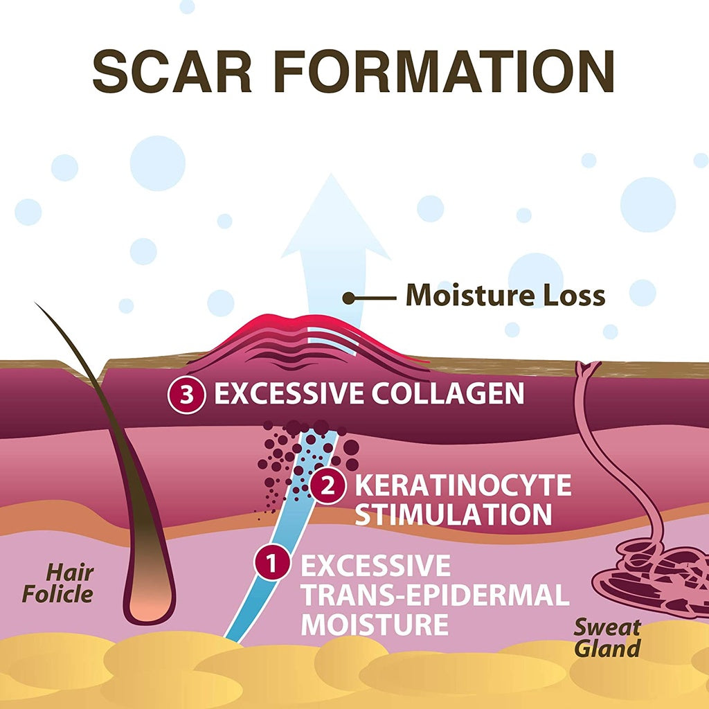 Xeragel 100% Silicone Ointment for Scars Reduce the Appearance of Old & New Scars, 0.33 oz. / 10g