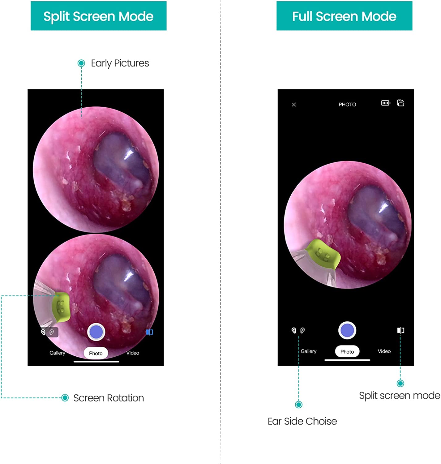 Any Kit Wireless Otoscope Ear Camera 720P HD With 6 LED Lights Compatible with Android and iPhone 1 Count