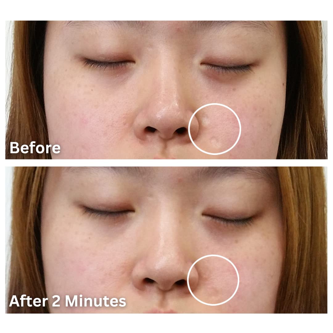 Dermaflage The Hollywood Topical Filler Applicator Bronze Medium 1 Count