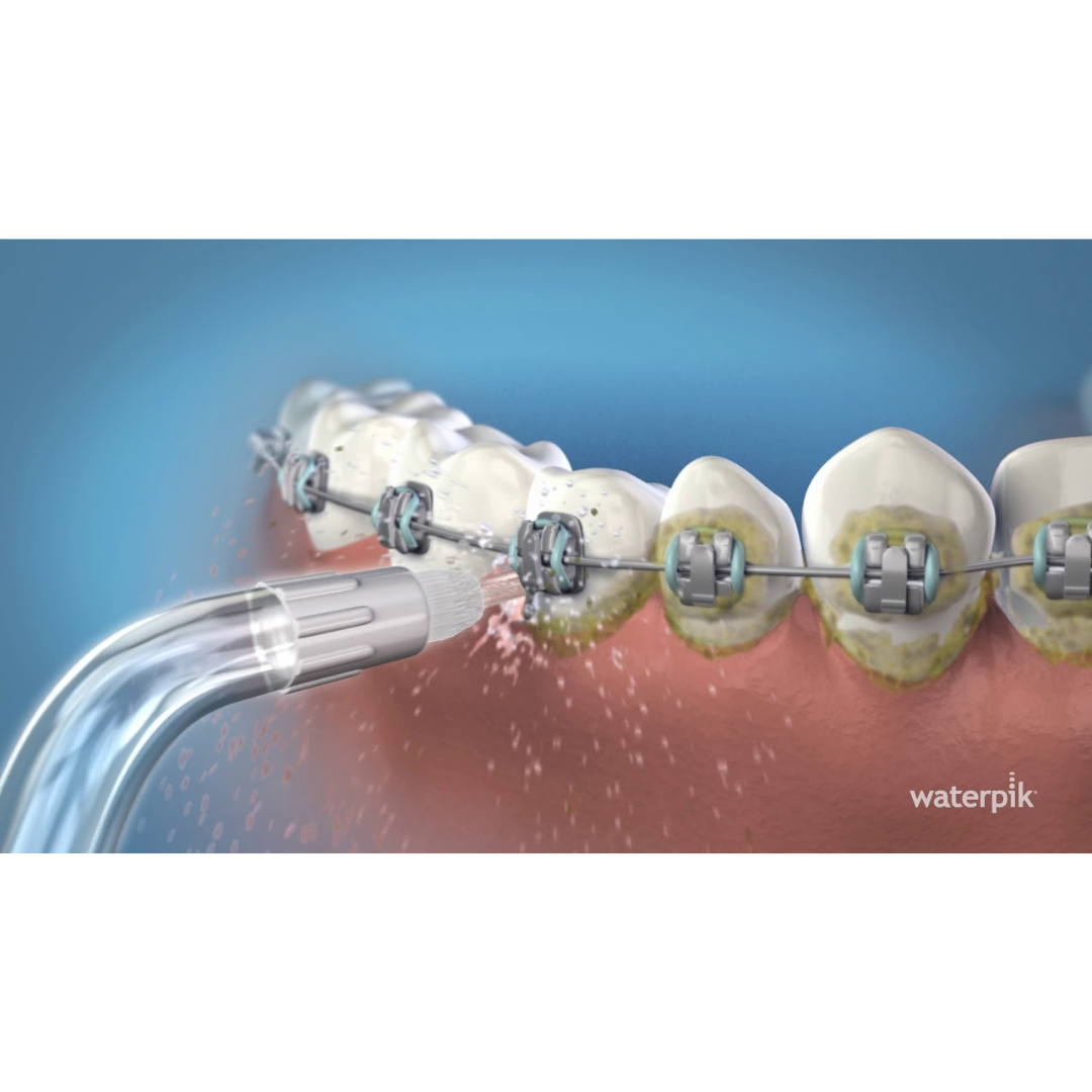 Tips (2 pc) - Orthodontic Tip