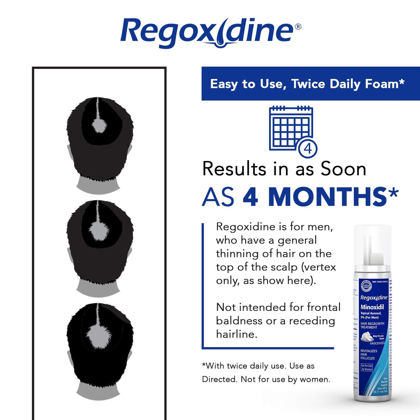 Regoxidine 5% Topical Aerosol Minoxidil Foam for Men Hair Regrowth Treatment Unscented PACKAGING MAY VARY