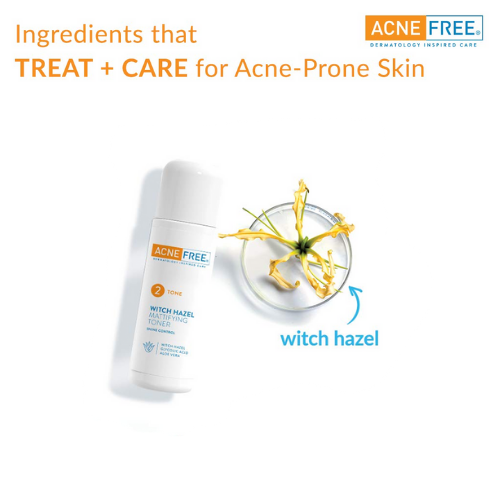 Witch Hazel Mattifying Toner with Glycolic Acid & Aloe Vera, 4 fl.oz