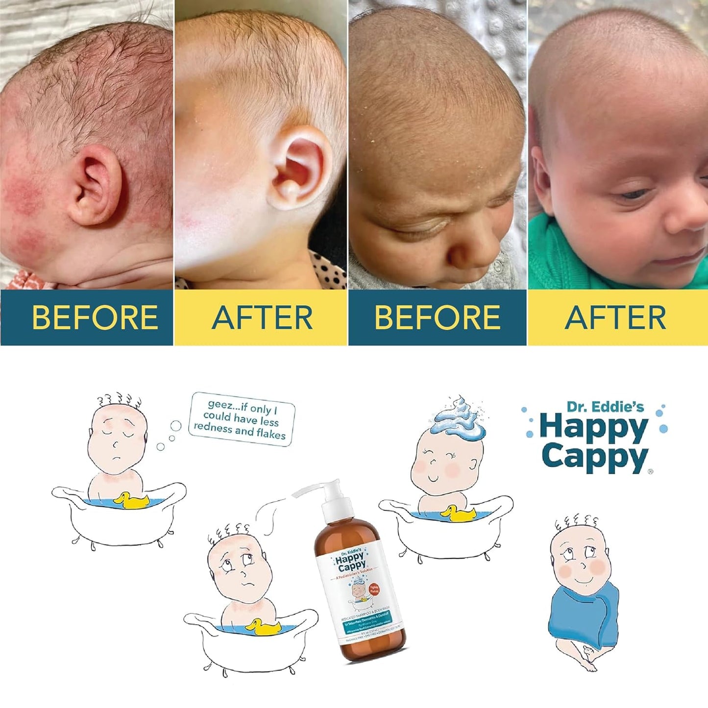 Happy Cappy Medicated Shampoo & Body Wash 8 fl oz / 237ml