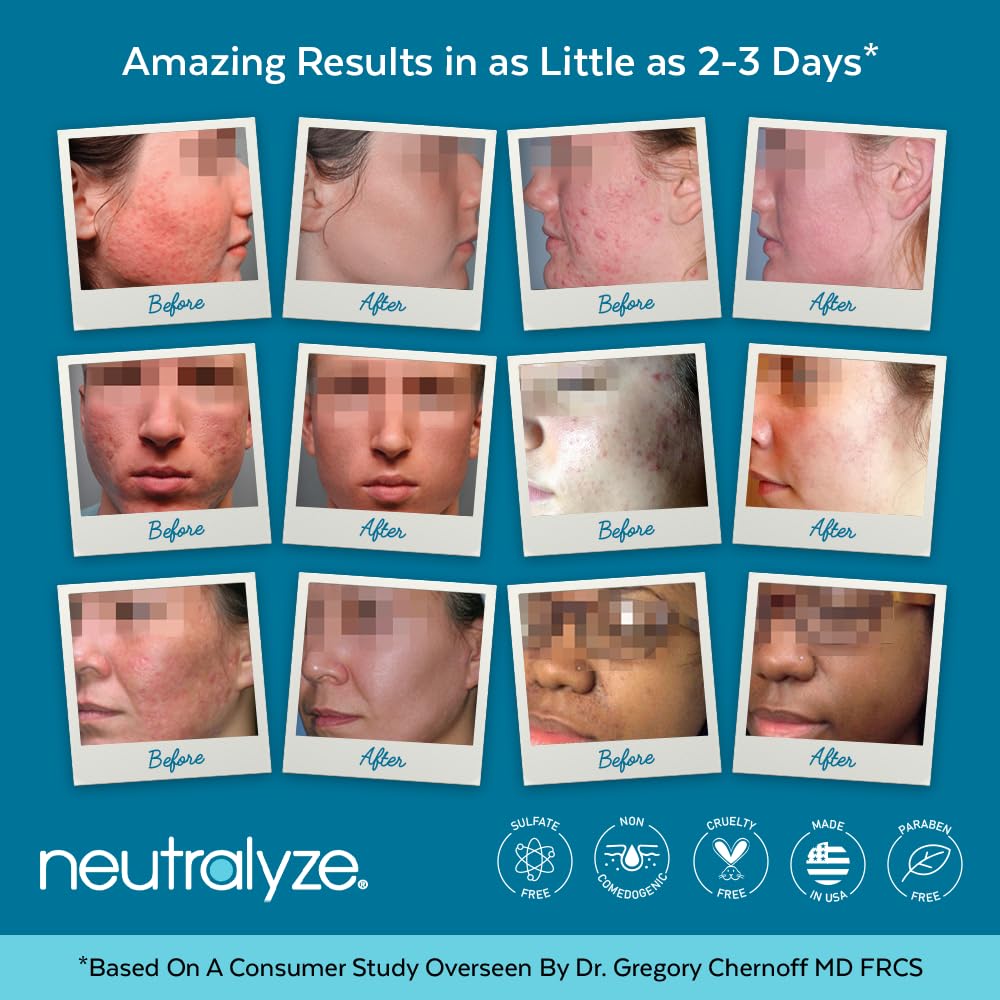 Neutralyze Exfoliating Toner Pads For Acne Prone Skin Rejuvenate, 100 Pads
