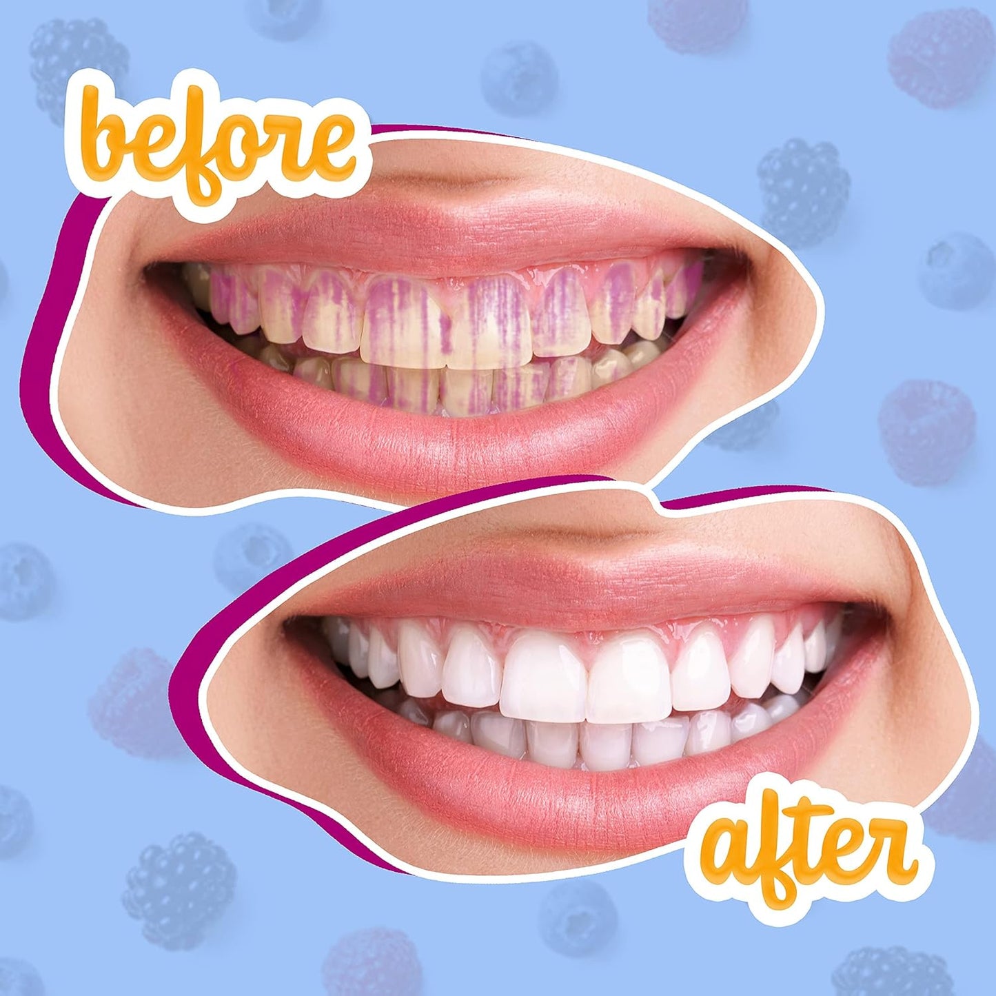 Dental Check Plaque Highlighting Chews Berry Flavor 120 Tablets