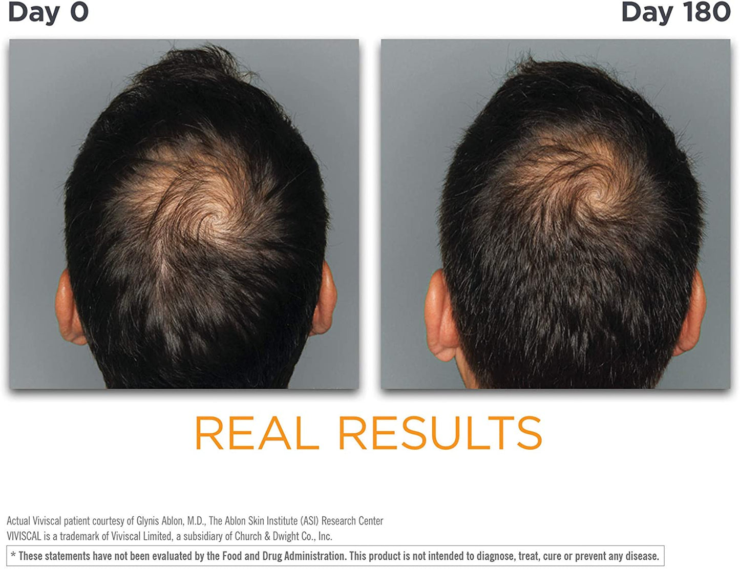 Viviscal MAN Hair Growth Supplement, 60 Tablets (NO BOX)