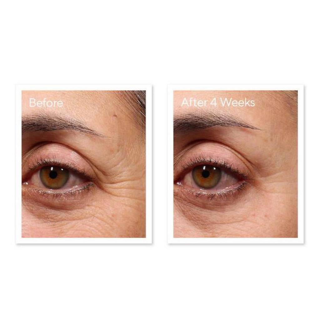 Murad Resurgence Retinol Youth Renewal Eye Serum - 0.5 fl.oz