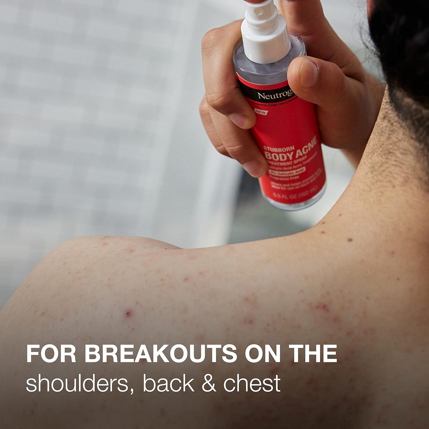 Neutrogena Stubborn Body Acne Spray 5.5 fl oz / 162ml