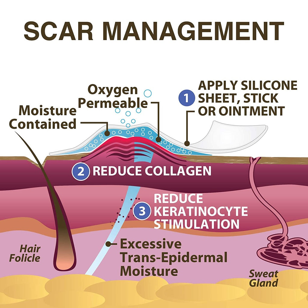 Xeragel 100% Silicone Ointment for Scars Reduce the Appearance of Old & New Scars, 0.33 oz. / 10g
