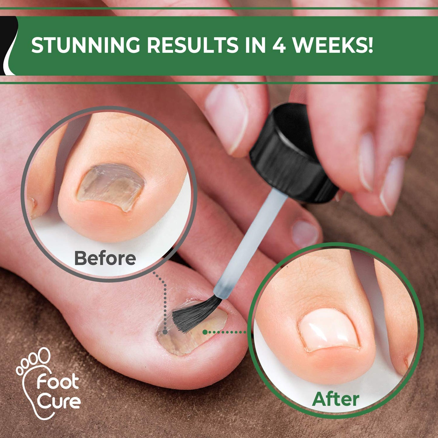 Foot Cure Nail Fungus Treatment, 15 ml