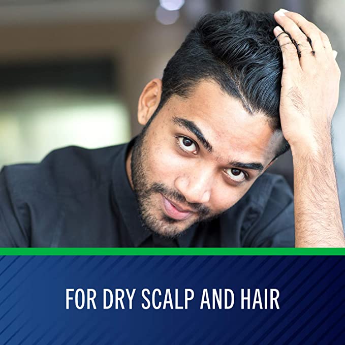 Maximum Strength Selsun Blue Anti Dandruff Shampoo 1% Selenium Sulfide Moisturizing 11 Fl Oz (325ml)