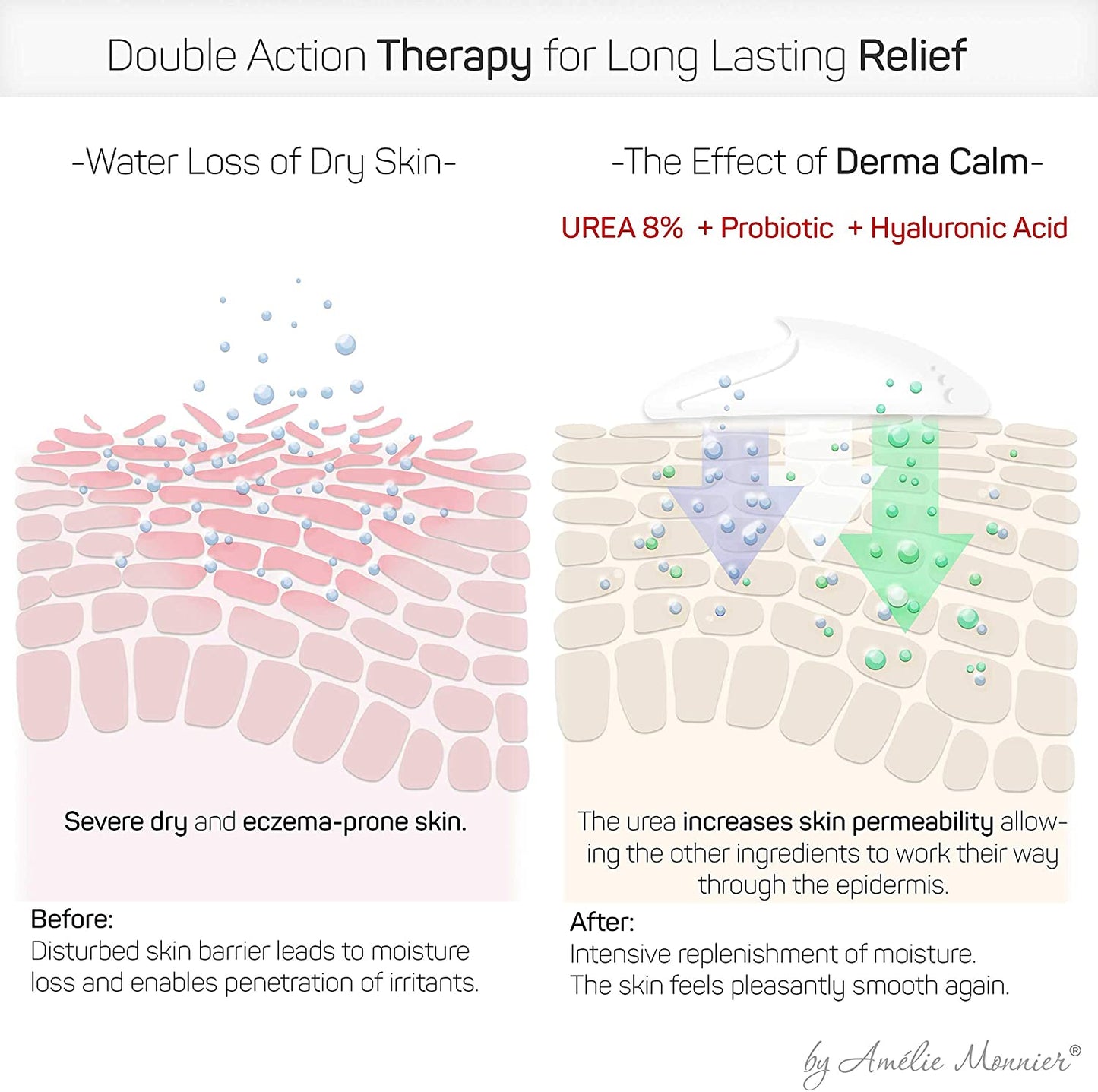 Amelie Monnier DermaCalm (SOS Therapy) Moisturizing Cream with 8% Urea, Probiotics & Hyaluronic Acid, 5 fl.oz / 150ml