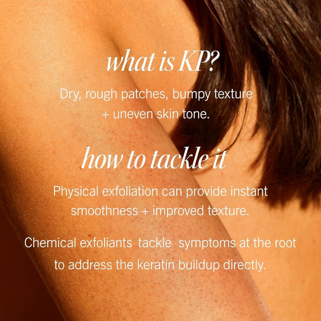 First Aid Beauty KP Bump Eraser Body Scrub, 226 g / 8 oz