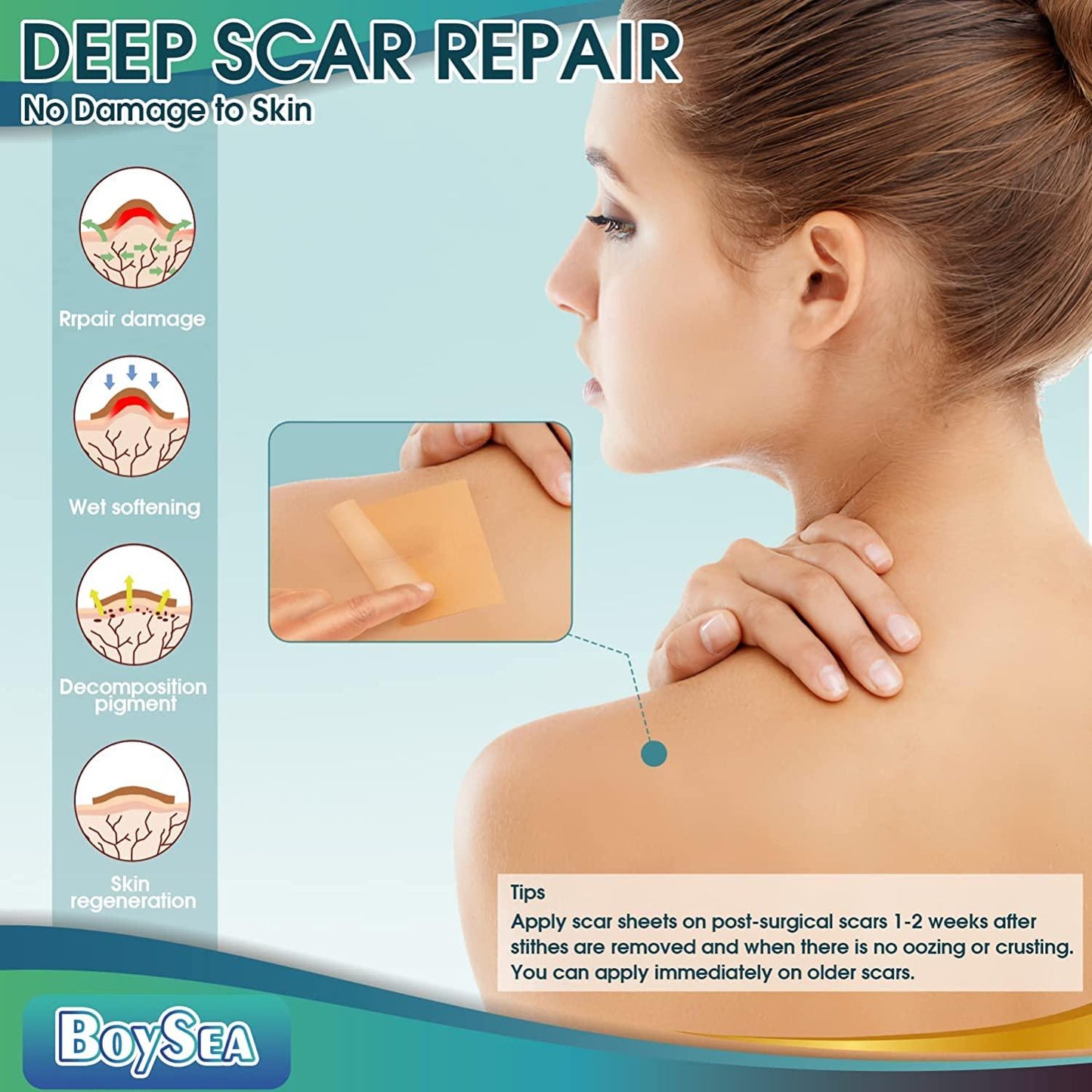 BoySea Silicone Scar Sheets Roll Size 1.6" x 150" / 4cmX3.8cm